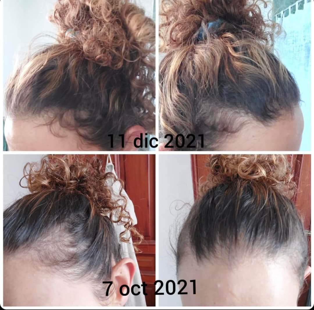 Hairapy Guatemala